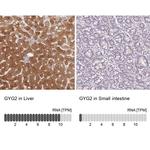 GYG2 Antibody in Immunohistochemistry (IHC)