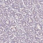 GYG2 Antibody in Immunohistochemistry (IHC)