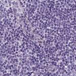 SHCBP1L Antibody in Immunohistochemistry (IHC)