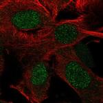 RTP4 Antibody in Immunocytochemistry (ICC/IF)