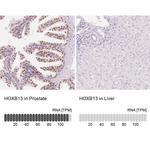 HOXB13 Antibody in Immunohistochemistry (IHC)