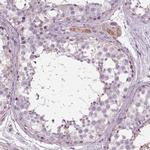 SAMD4A Antibody in Immunohistochemistry (IHC)