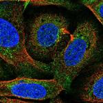 Ferroportin Antibody in Immunocytochemistry (ICC/IF)