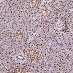 TOPORS Antibody in Immunohistochemistry (IHC)