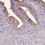 INPP5E Antibody in Immunohistochemistry (IHC)