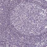 GLUT9 Antibody in Immunohistochemistry (IHC)