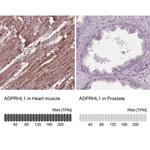 ADPRHL1 Antibody in Immunohistochemistry (IHC)