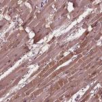 ADPRHL1 Antibody in Immunohistochemistry (IHC)