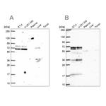 GTF3C5 Antibody in Western Blot (WB)