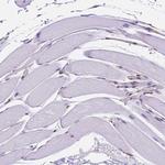 Importin 11 Antibody in Immunohistochemistry (IHC)