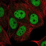 TAF6L Antibody in Immunocytochemistry (ICC/IF)