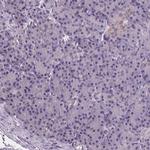 MLC1 Antibody in Immunohistochemistry (IHC)