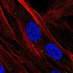 SBSN Antibody in Immunocytochemistry (ICC/IF)