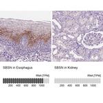 SBSN Antibody in Immunohistochemistry (IHC)