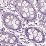 SBSN Antibody in Immunohistochemistry (IHC)