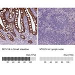 MYH14 Antibody in Immunohistochemistry (IHC)