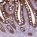 MYH14 Antibody in Immunohistochemistry (IHC)