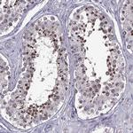 EP400NL Antibody in Immunohistochemistry (IHC)