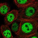 NCAPH2 Antibody in Immunocytochemistry (ICC/IF)