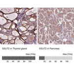 SSU72 Antibody in Immunohistochemistry (IHC)