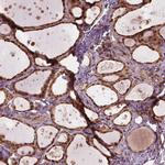 SSU72 Antibody in Immunohistochemistry (IHC)