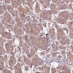 SSU72 Antibody in Immunohistochemistry (IHC)