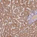 MTCO1 Antibody in Immunohistochemistry (IHC)