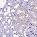 DHRS2 Antibody in Immunohistochemistry (IHC)