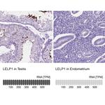 LELP1 Antibody
