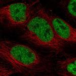 PHAX Antibody in Immunocytochemistry (ICC/IF)