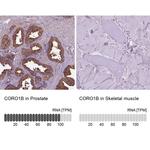 Coronin 1B Antibody