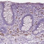 CD84 Antibody in Immunohistochemistry (IHC)