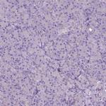 CD84 Antibody in Immunohistochemistry (IHC)