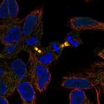 LIAR Antibody in Immunocytochemistry (ICC/IF)