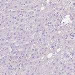 GAL3ST2 Antibody in Immunohistochemistry (IHC)