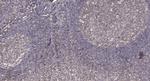 Phospho-PKC beta (Ser660) Antibody in Immunohistochemistry (Paraffin) (IHC (P))