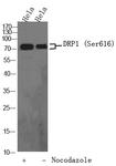 Phospho-DRP1 (Ser616) Antibody in Western Blot (WB)