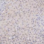 C1r Antibody in Immunohistochemistry (IHC)