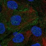 DLG5 Antibody in Immunocytochemistry (ICC/IF)