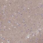 CACNG4 Antibody in Immunohistochemistry (IHC)