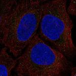 Serine racemase Antibody in Immunocytochemistry (ICC/IF)