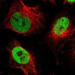 NFIX Antibody in Immunocytochemistry (ICC/IF)