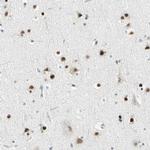 IMPG2 Antibody in Immunohistochemistry (IHC)