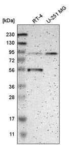 GCS1 Antibody in Western Blot (WB)