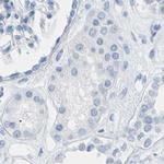 Opsin Blue Antibody in Immunohistochemistry (IHC)