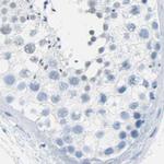 Opsin Blue Antibody in Immunohistochemistry (IHC)