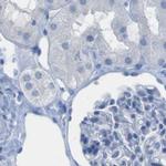 Opsin Blue Antibody in Immunohistochemistry (IHC)