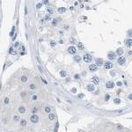 Opsin Blue Antibody in Immunohistochemistry (IHC)