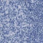 Opsin Blue Antibody in Immunohistochemistry (IHC)