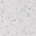 Opsin Blue Antibody in Immunohistochemistry (IHC)